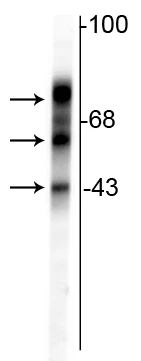 Anti-Tau Antibody
