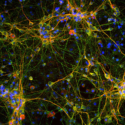 Anti-Tau Antibody - Image 2