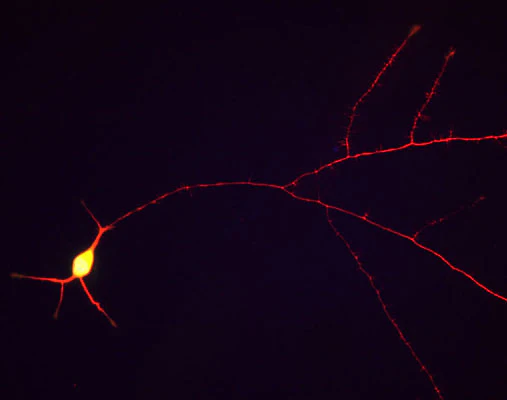Anti-Tau Antibody - Image 3
