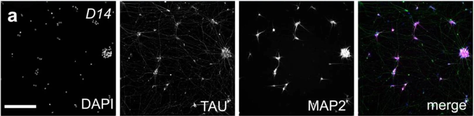 Anti-Tau Antibody - Image 4