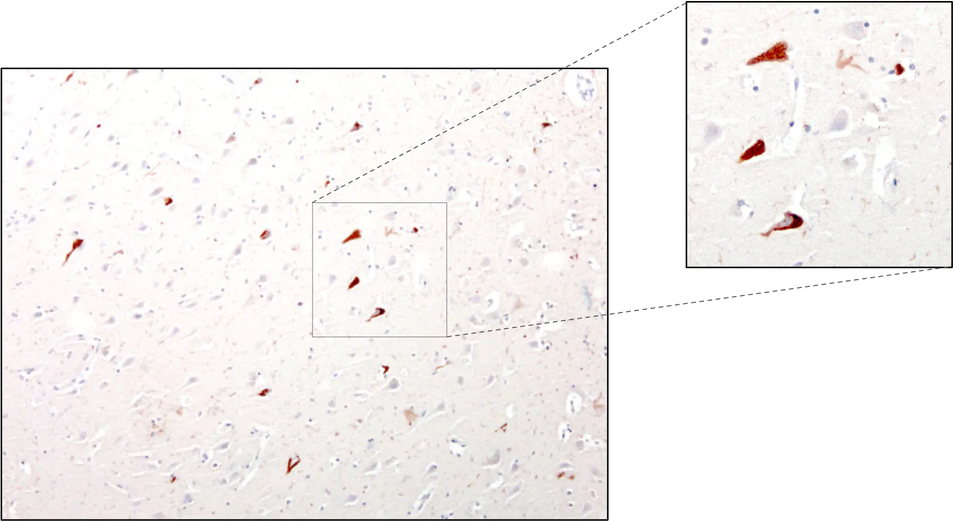 Anti-Tau Antibody