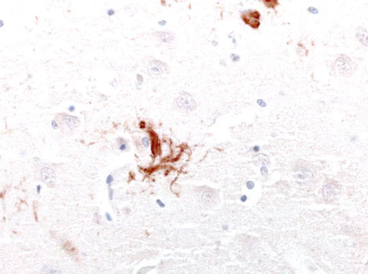 Anti-Tau Antibody - Image 2