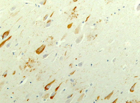 Anti-Tau Antibody - Image 3