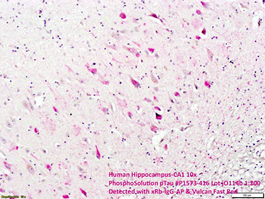 Anti-Tau (Ser416) Antibody - Image 2