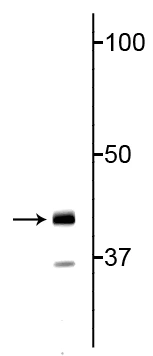 Anti-TDP43 Antibody