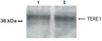 Anti-TERE1 Antibody