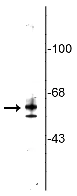 Anti-Testicular Receptor 2 (TR2) Antibody