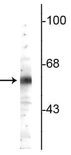 Anti-Testicular Receptor 4 (TR4) Antibody
