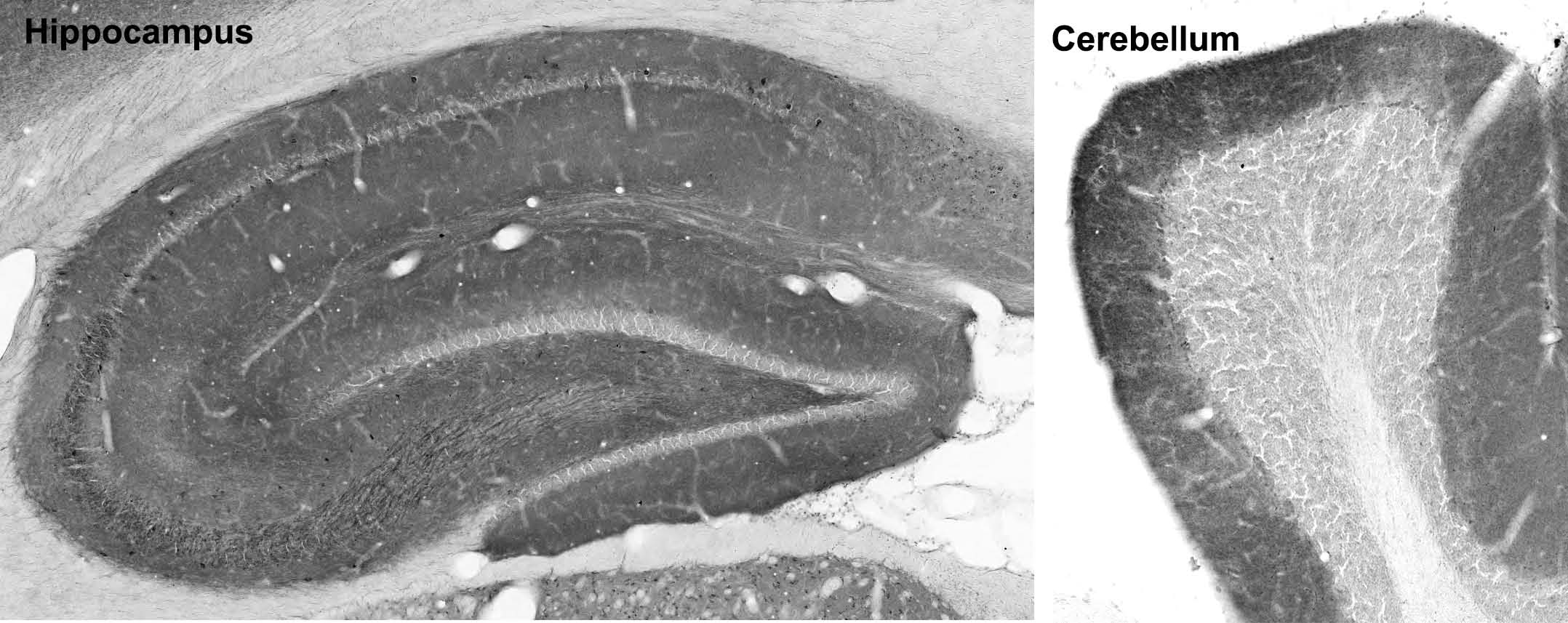 Anti-THIK-2 Antibody