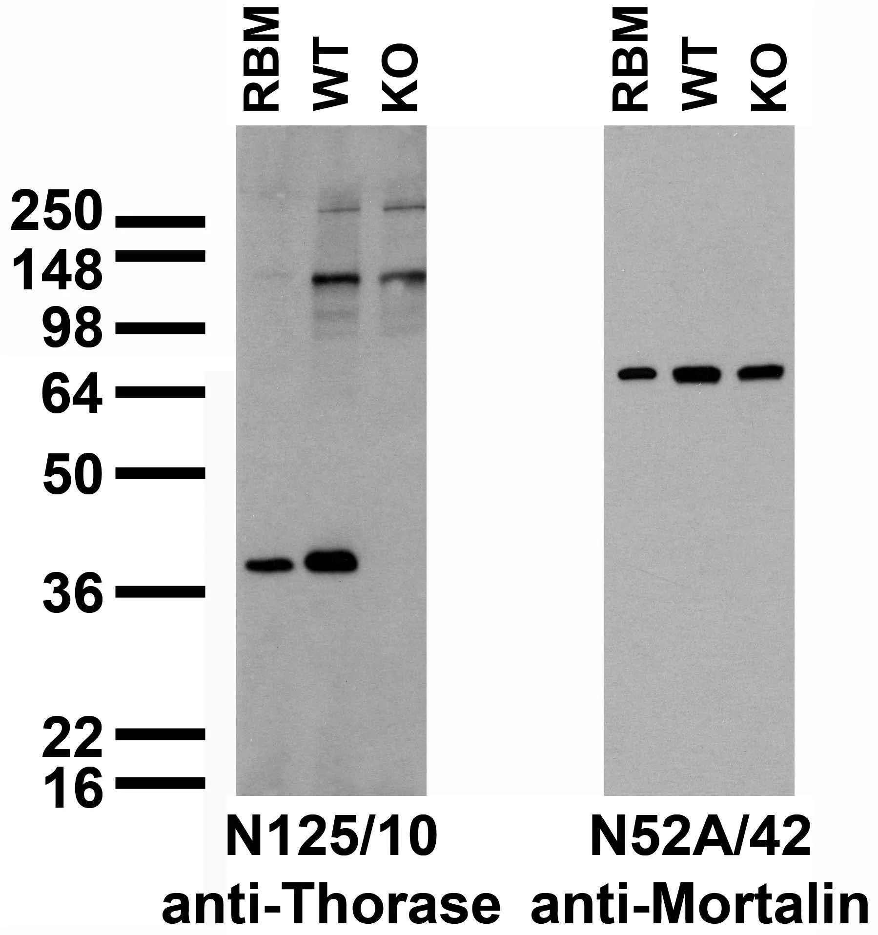 Anti-Thorase/Atad1 Antibody - Image 2