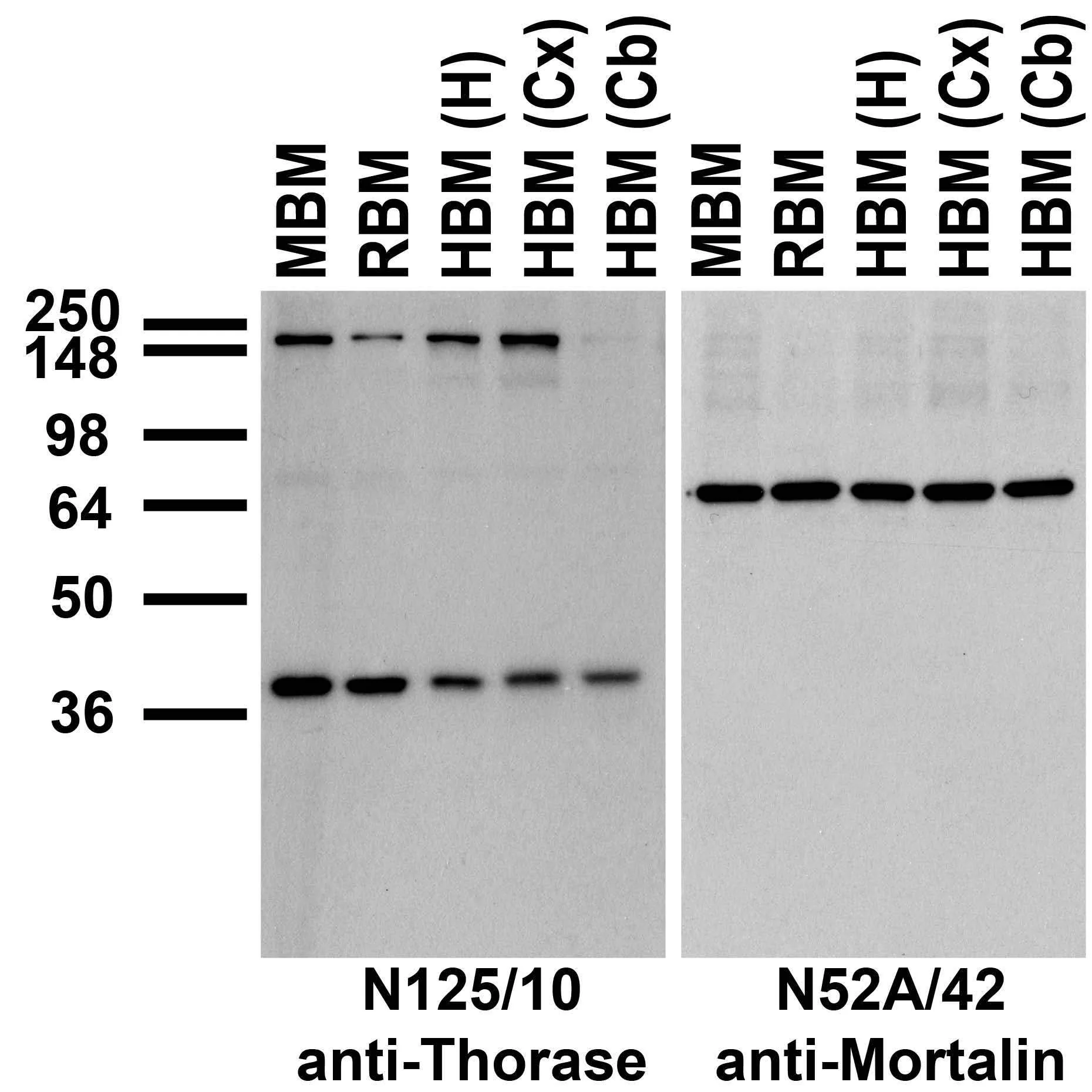 Anti-Thorase/Atad1 Antibody - Image 4