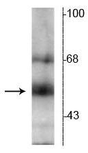 Anti-Thyroid Hormone Receptor, ß-Isotype Antibody