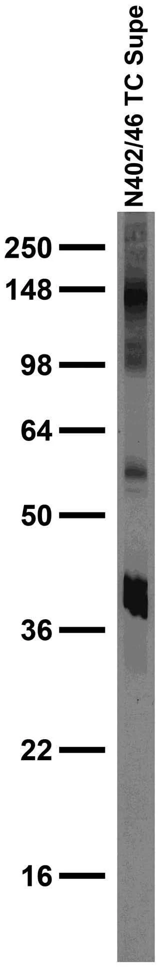 Anti-Thyroid Hormone Receptor Beta1 Antibody