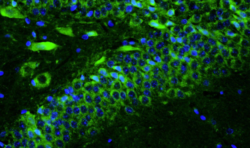 Anti-TMEM240 Recombinant Chicken Chimeric mAb