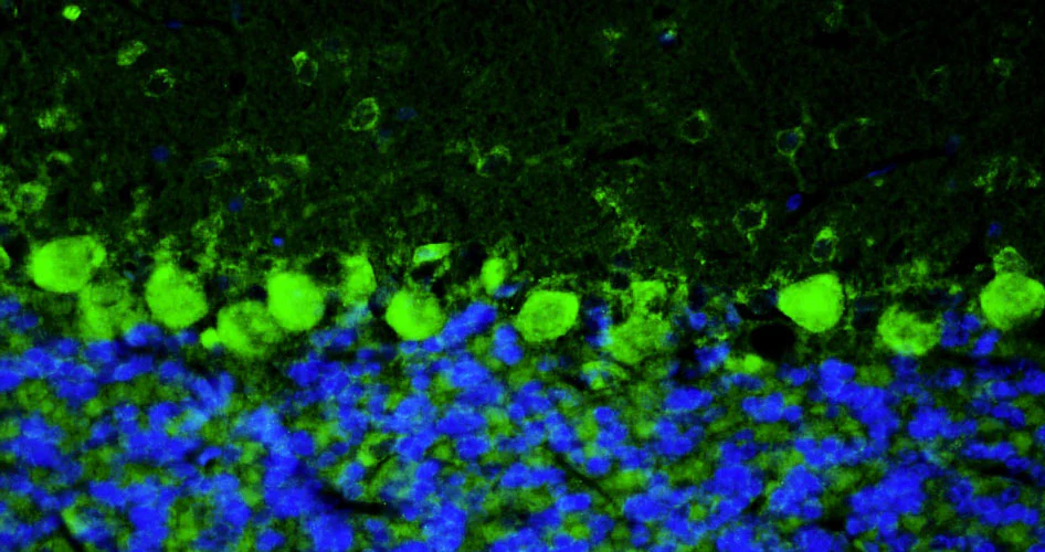 Anti-TMEM240 Recombinant Chicken Chimeric mAb - Image 4