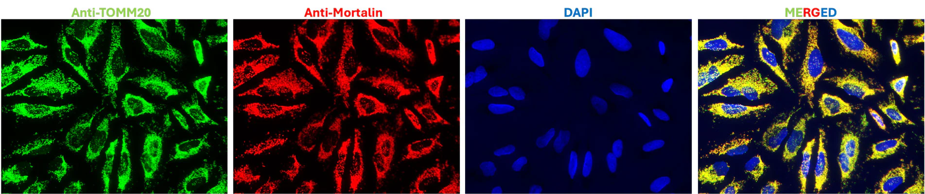 Anti-TOMM20 Antibody