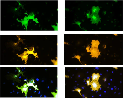 Anti-TPH2 Antibody