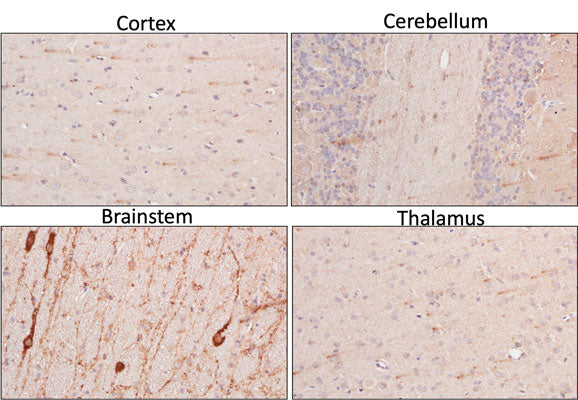 Anti-TPH2 Antibody - Image 3