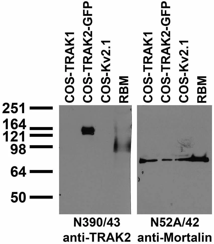 Anti-TRAK2 Antibody