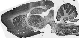 Anti-TRAK2 Antibody - Image 2