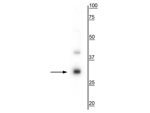 Anti-TREM2 Antibody