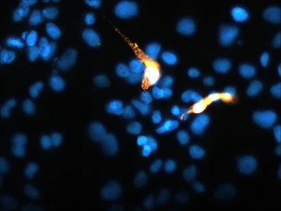 Anti-TREM2 Antibody