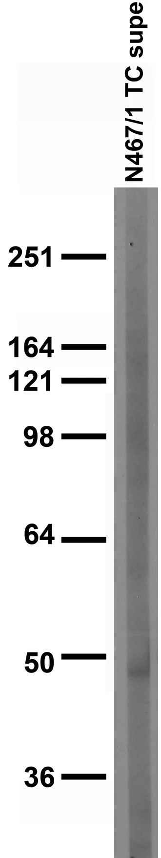 Anti-TRESK Antibody