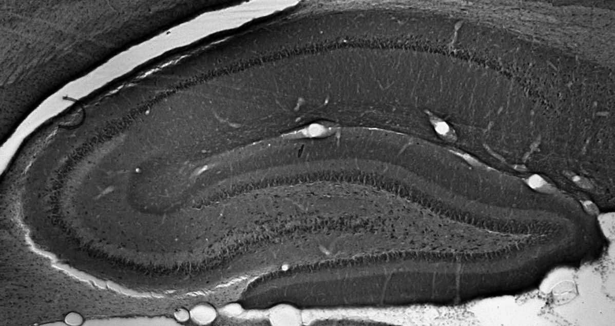 Anti-TRIP8b (Constant) Antibody - Image 2