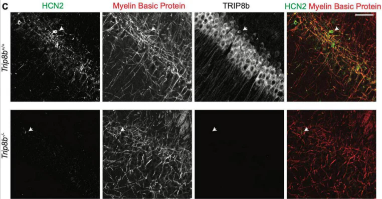Anti-TRIP8b (Constant) Antibody - Image 4