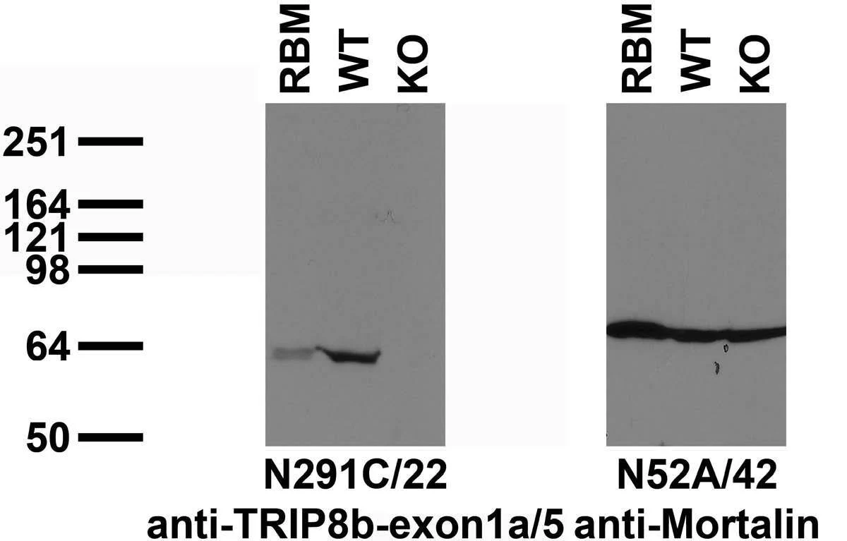 Anti-TRIP8B (Exon 1A/5 Junction) Antibody