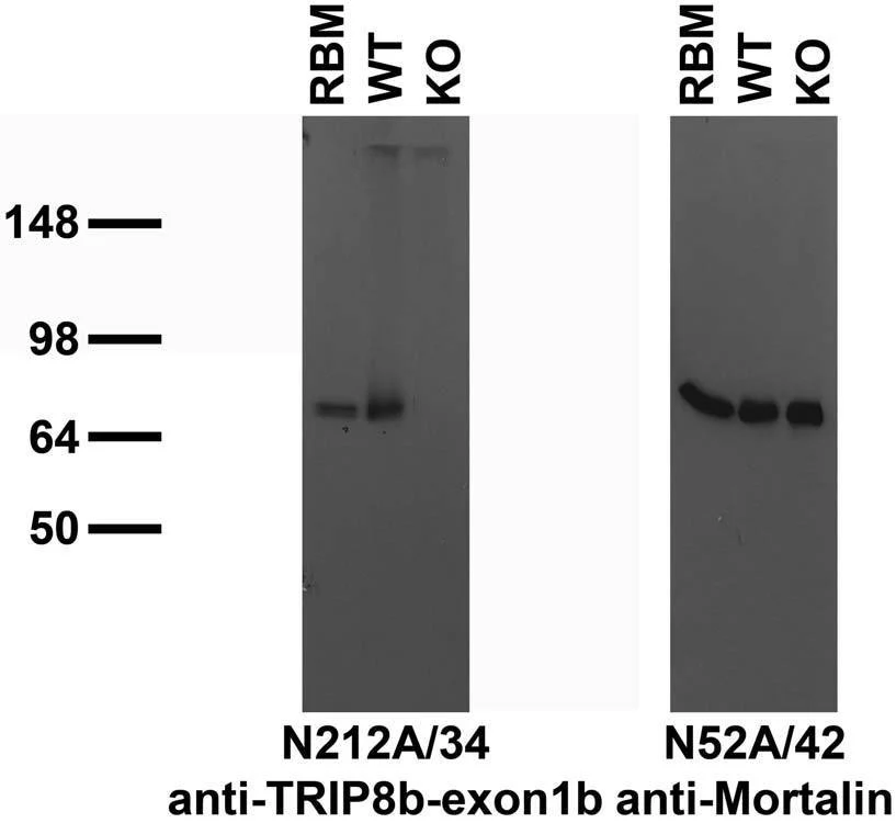 Anti-TRIP8b (Exon 1b) Antibody - Image 2