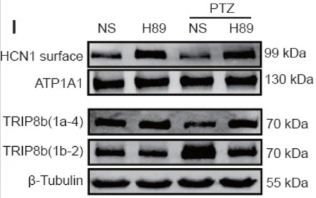 Anti-TRIP8b (Exon 1b) Antibody - Image 4