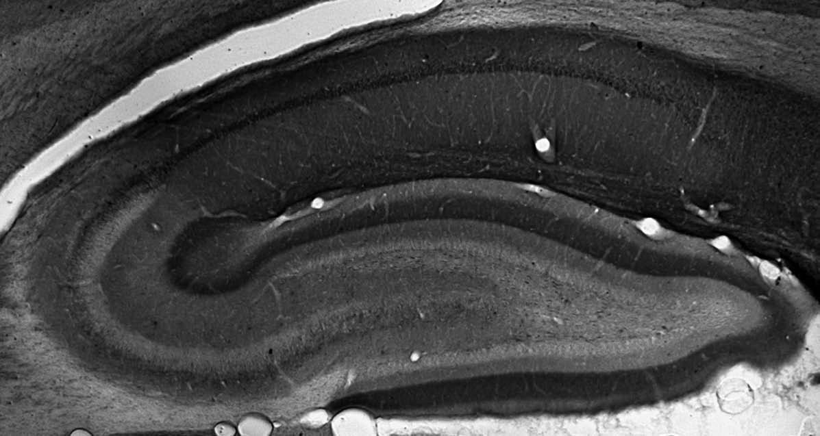 Anti-TRIP8b (Exon 4) Antibody - Image 3