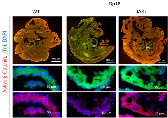 Anti-Troponin I (cardiac) Antibody - Image 3