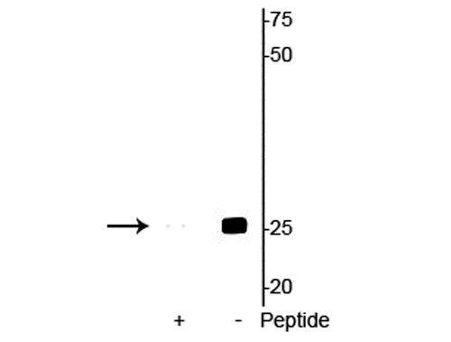 Anti-Troponin I (cardiac) Ser23/24 Antibody