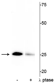 Anti-Troponin I (cardiac) Ser43 Antibody