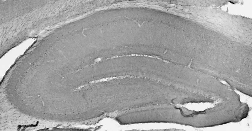 Anti-TrpC4 Antibody - Image 2