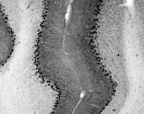 Anti-TrpC5 Antibody - Image 2