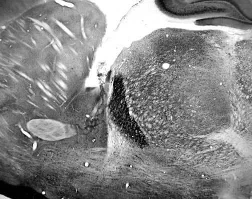 Anti-TrpC5 Antibody - Image 3