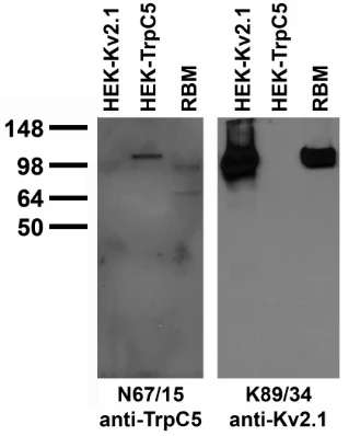 Anti-TrpC5 Antibody - Image 4