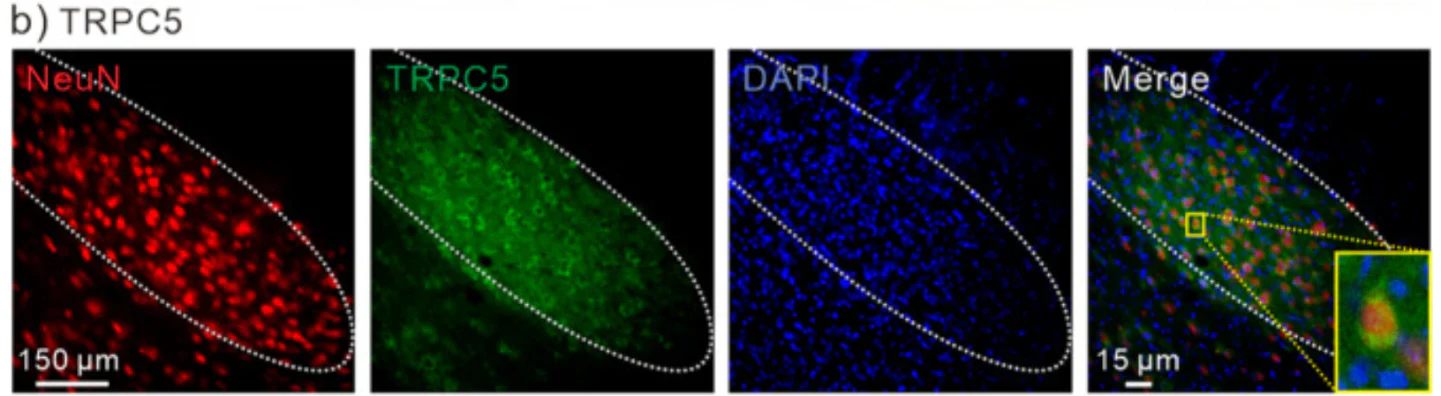 Anti-TrpC5 Antibody - Image 7