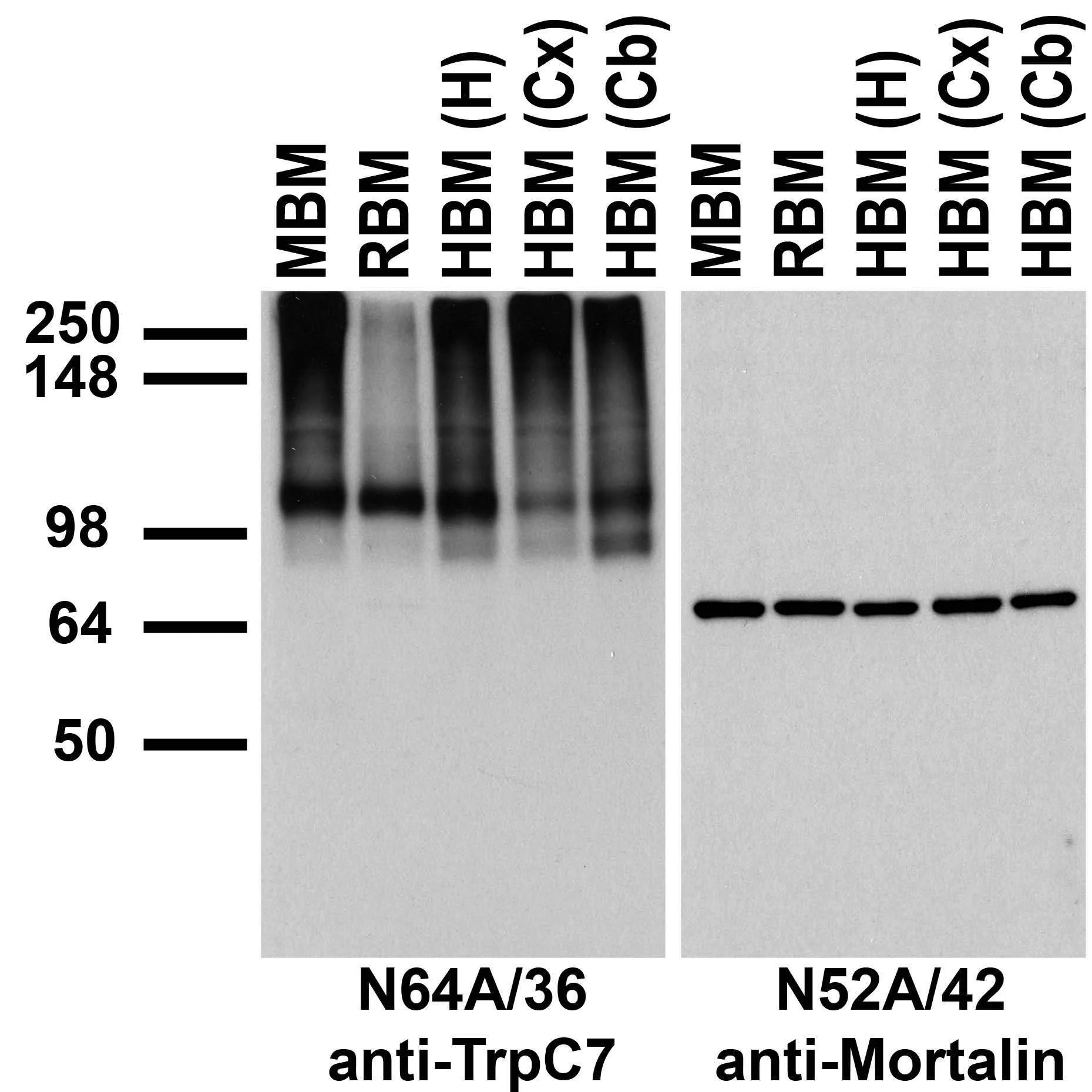 Anti-TrpC7 Antibody - Image 2