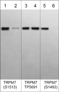 Anti-TRPM7 (cytoplasmic region) Antibody