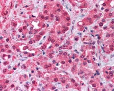 Anti-TRPM8 Antibody