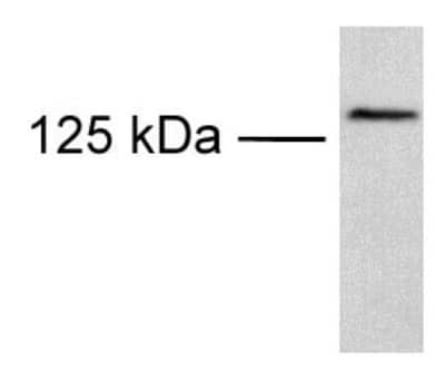 Anti-TRPM8 Antibody - Image 2