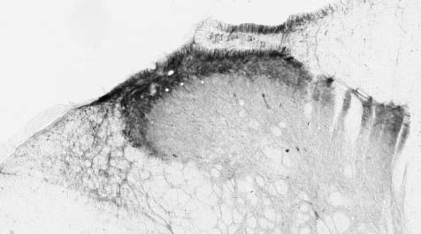 Anti-TrpV1 Antibody - Image 2