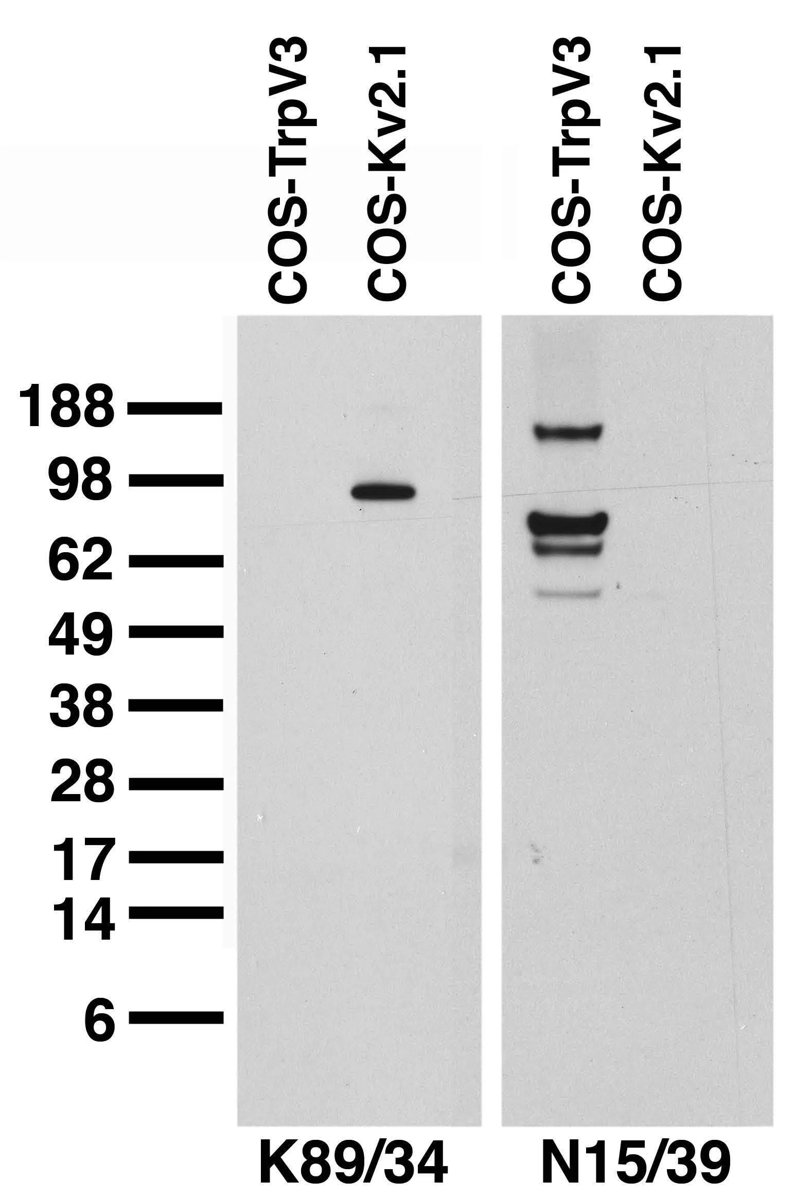 Anti-TrpV3 Antibody