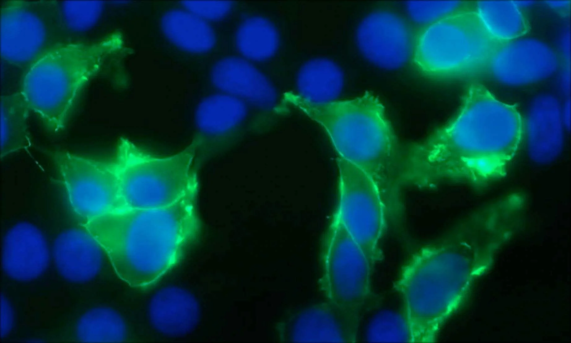 Anti-TrpV3 Antibody - Image 2