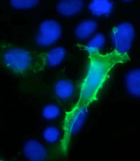 Anti-TrpV3 Antibody