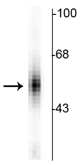 Anti-Tryptophan Hydroxylase Antibody